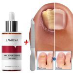 سرم ترمیم و تقویت ناخن لانبنا LANBENA - Image 2